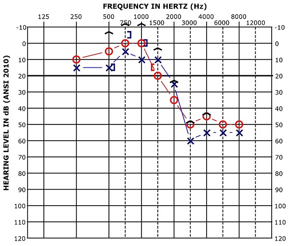 Audiology Report